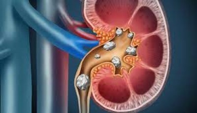Arthritis & Rheumatism